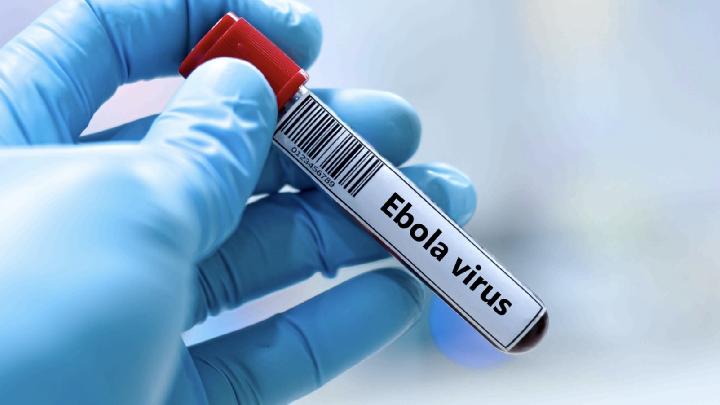 France Reports First Congo Outbreak Linked Ebola Case